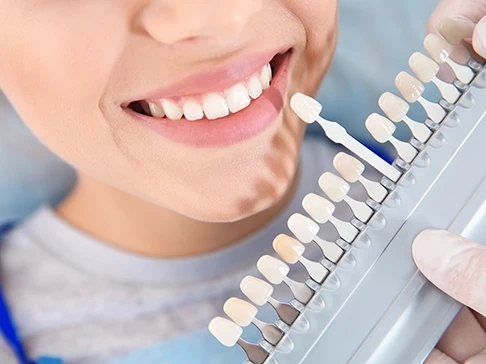 Mujer eligiendo color para su Blanqueamiento dental en Ciudad Real