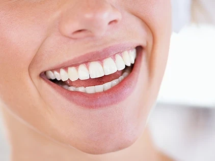 Mujer con un Blanqueamiento dental en Ciudad Real