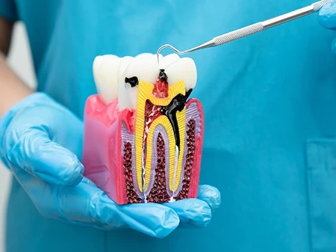 Maqueta de una Endodoncia en Ciudad Real
