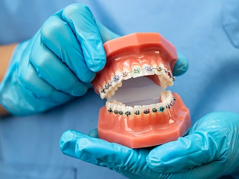 Aparato dental Ciudad Real Maqueta de un Aparato dental en Ciudad Real