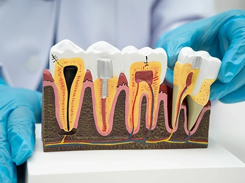 Maqueta de una periodoncia en ciudad real