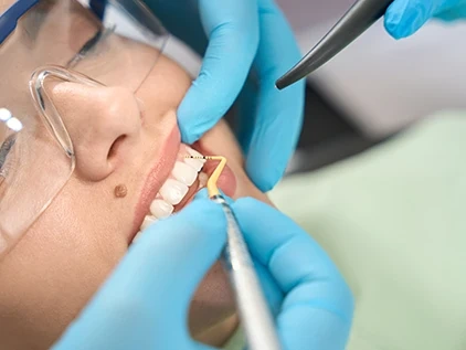Imagen de una mujer recibiendo una periodoncia en ciudad real